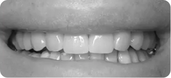 Dental treatment after procedure in Phoenix, AZ